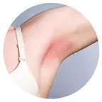 Depilacja